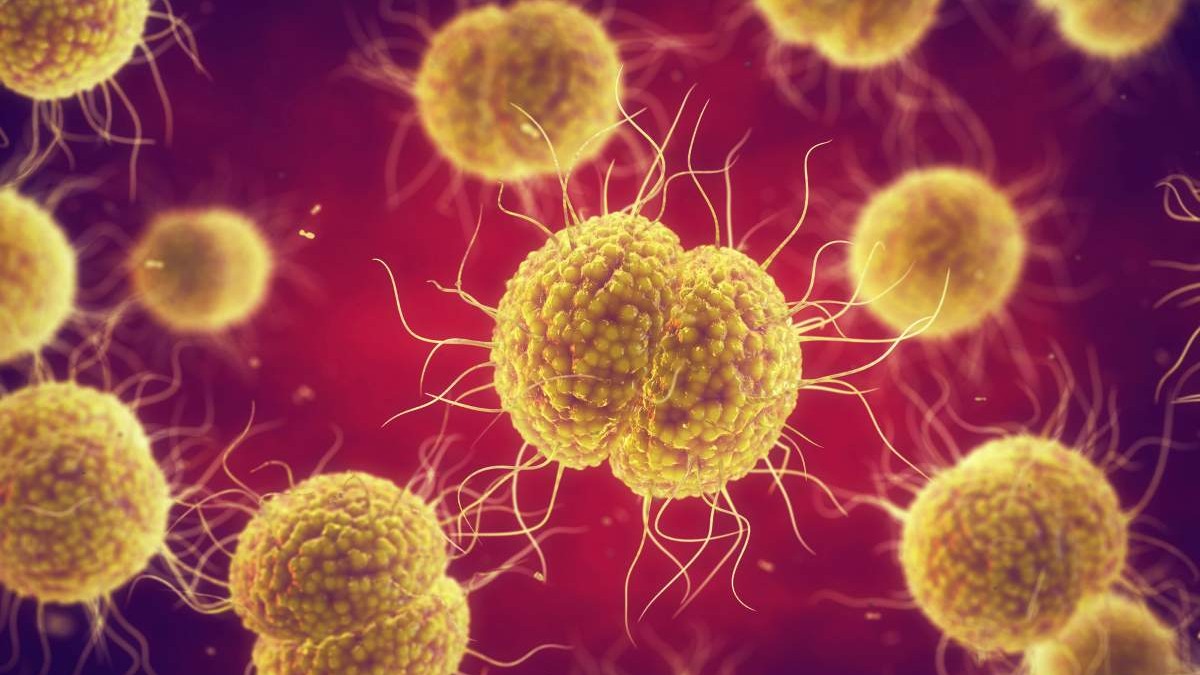 Rapid diagnostic test prevents antibiotic overuse in a busy, urban STI clinic