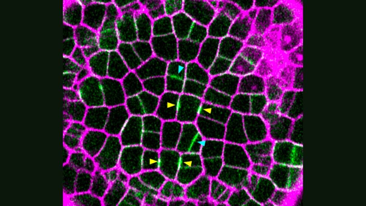 How plants control the shape of stems, fruits and other organs
